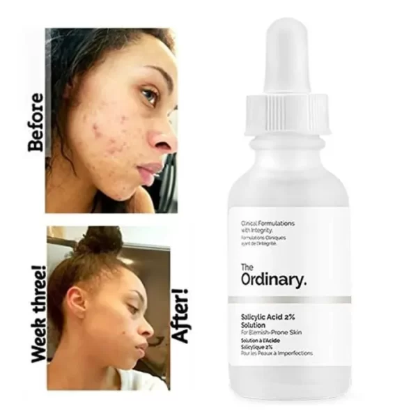 The Ordinary Salicylic Acid 2% Solution 30 ml - PARC-T2-061-30